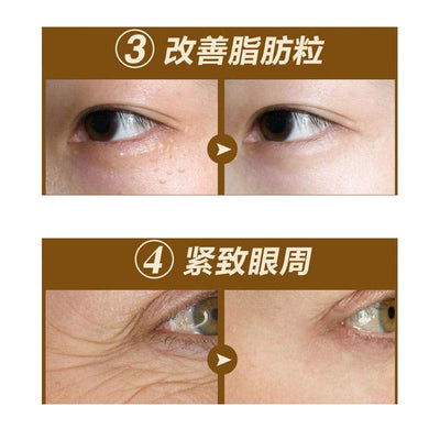 Korea black pearl Collagen eye mask